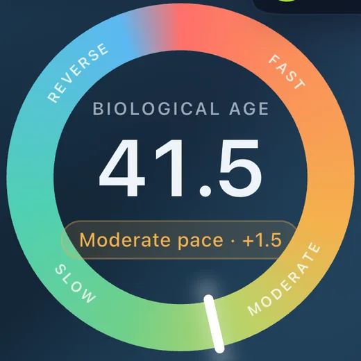 Edad biológica de 41,5 años, en ritmo moderado